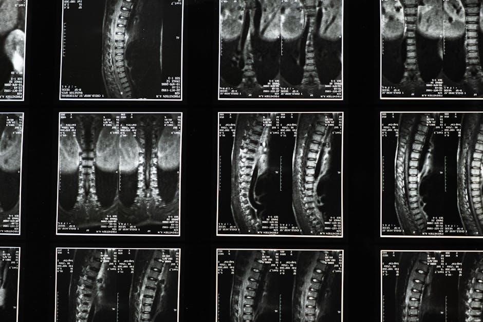 exercises for lower back pain and sciatica pdf